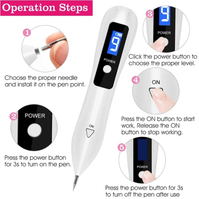 Portable Skin Tag Remover