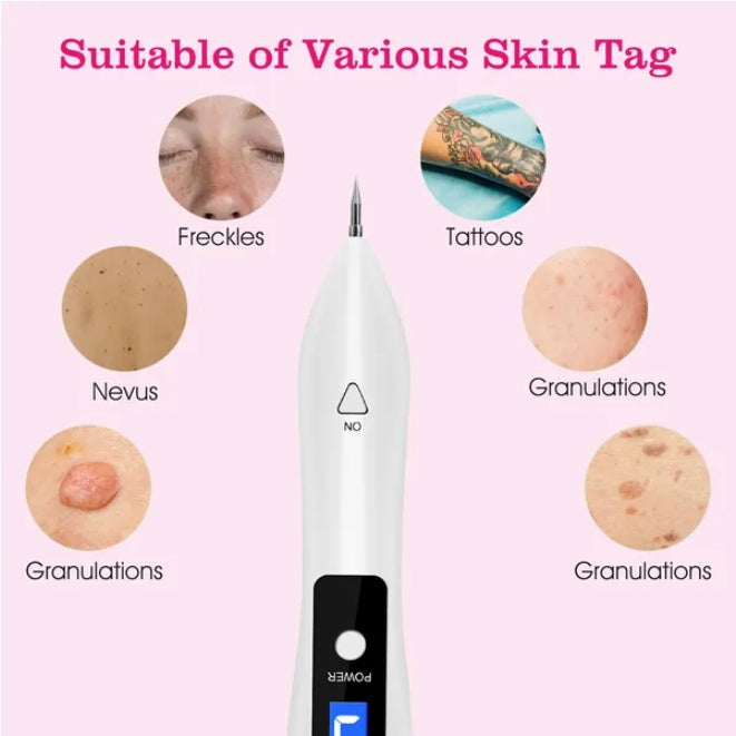 Portable Skin Tag Remover